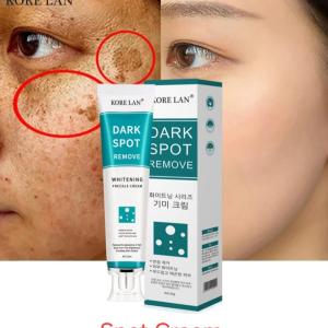 MOOYAM Dark Spot Removal Freckle Cream 30g