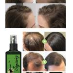 aysuing Hair Root Nutrients